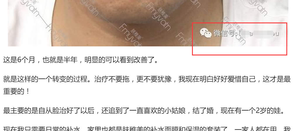 如何通过今日头条引精准流量,学完即用-第7张图片-智慧创业网 如何通过今日头条引精准流量,学完即用-第7张图片-智慧创业网